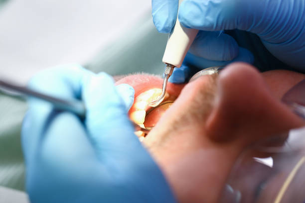 Best Emergency Tooth Extraction  in Fox Island, WA