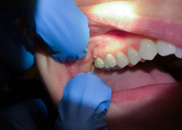 Best Tooth Pain Emergency Relief  in Fox Island, WA